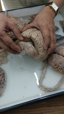 NIMHANS Brain Museum NIMHANS Brain Museum